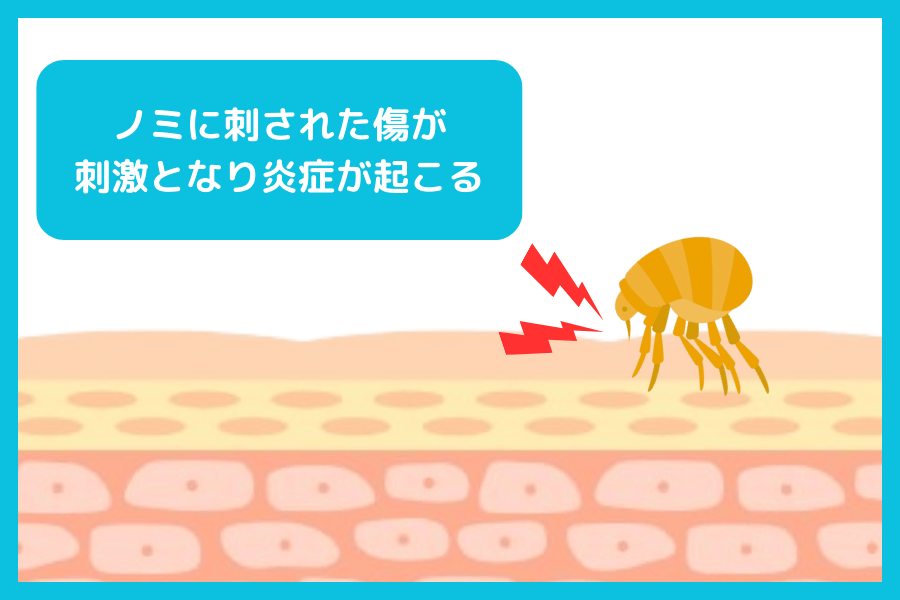 ノミ刺咬性皮膚炎