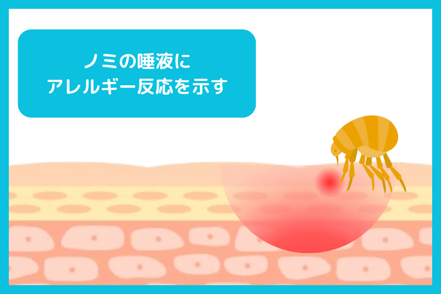 ノミアレルギー性皮膚炎