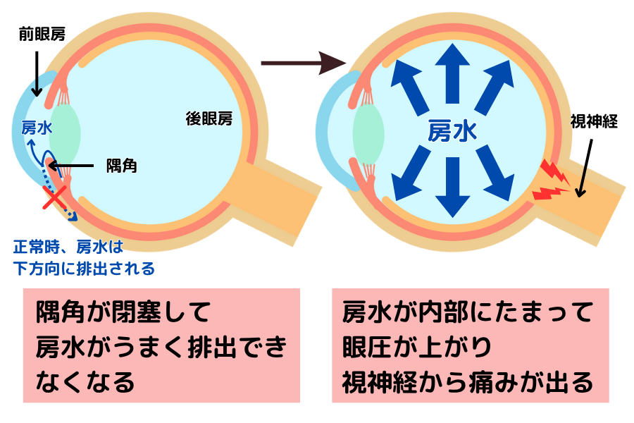犬の緑内障とは？眼圧が上がるメカニズム