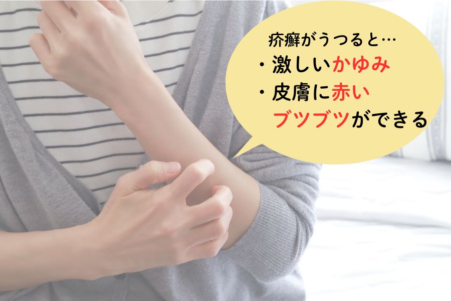 疥癬が人にうつるとどうなる?